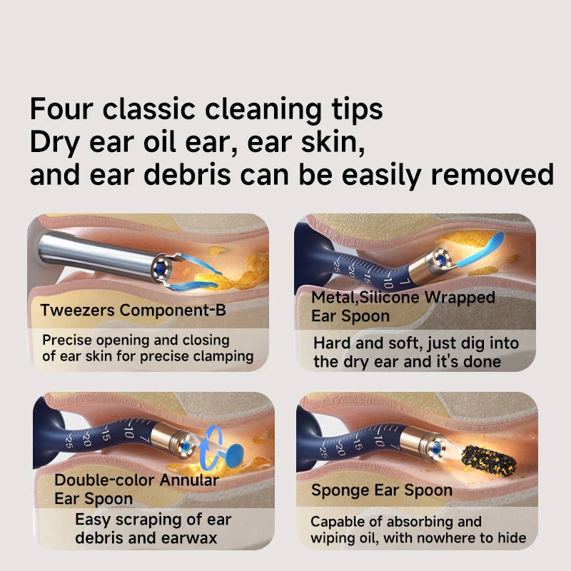 Bebird Smart Ear Scope