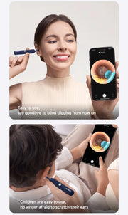 Bebird Smart Ear Scope