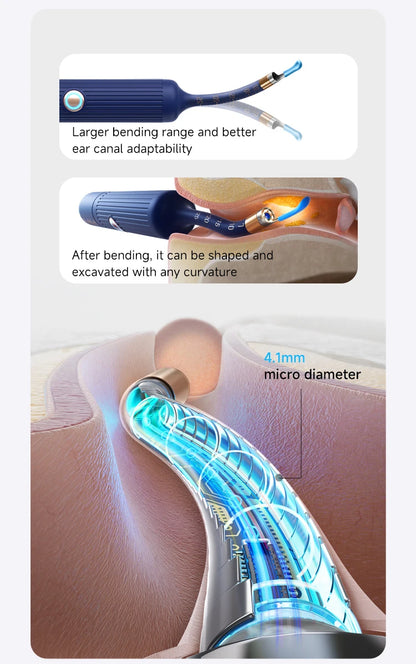Bebird Smart Ear Scope