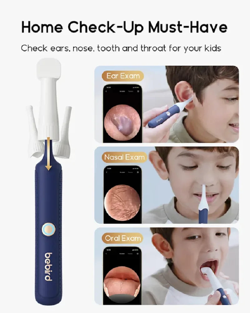 Bebird Smart Ear Scope