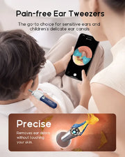 Bebird Smart Ear Scope