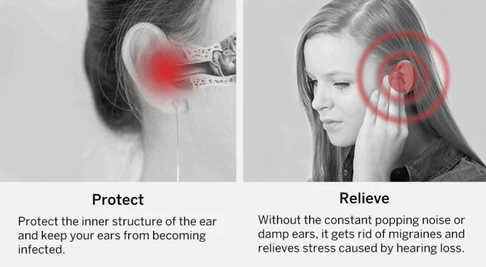 Bebird Smart Ear Scope